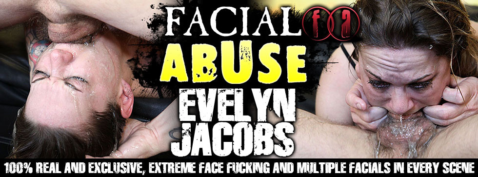 Facial Abuse Evelyn Jacobs